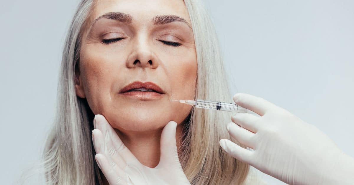 Rejuvenation with Fillers